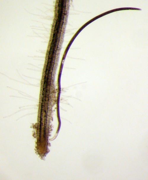 A nematode feeding on a plant root